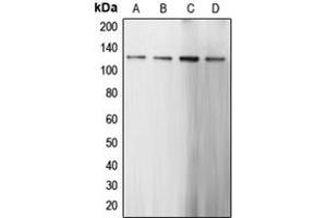 Western blot analysis of CARD6 expression in HeLa (A), Jurkat (B), mouse kidney (C), rat brain (D) whole cell lysates. (CARD6 抗体  (N-Term))