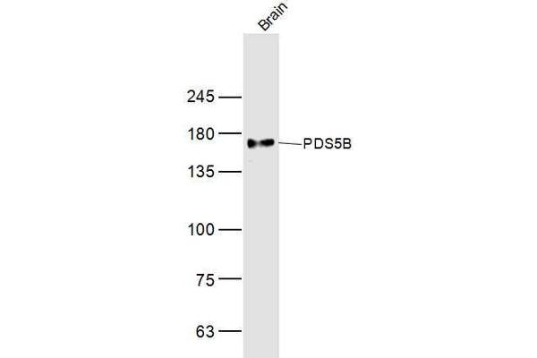 PDS5B 抗体  (AA 1051-1150)