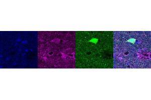 Immunohistochemistry (IHC) image for anti-Ubiquitin Carboxyl-terminal Esterase L1 (Ubiquitin Thiolesterase) (UCHL1) antibody (ABIN7456011)