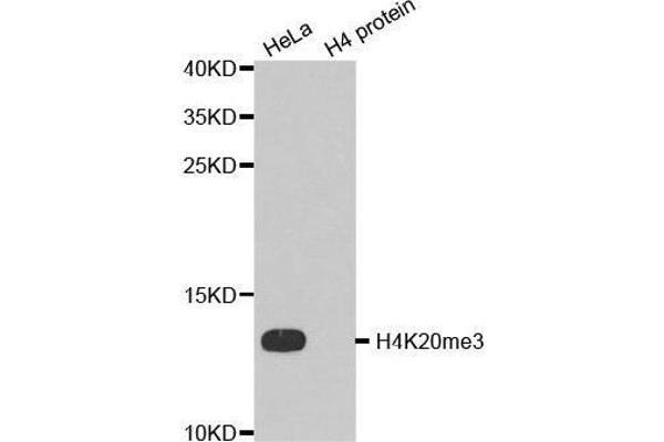 Histone H4 抗体  (3meLys20)