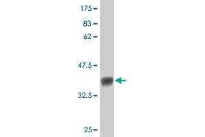 Western Blot detection against Immunogen (36. (FLT4 抗体  (AA 34-133))