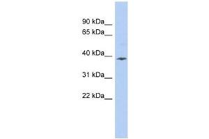 APOL6 antibody used at 0. (APOL6 抗体  (Middle Region))