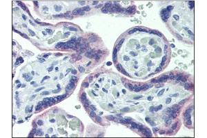 Human Placenta: Formalin-Fixed, Paraffin-Embedded (FFPE) (OR51E1 抗体)