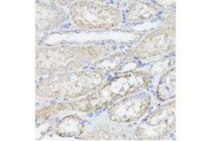 Immunohistochemistry (IHC) image for anti-Caspase 8 (CASP8) (AA 1-479) antibody (ABIN6137970)