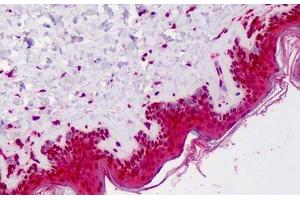 Human Skin: Formalin-Fixed, Paraffin-Embedded (FFPE) (NLRP3 抗体  (N-Term))