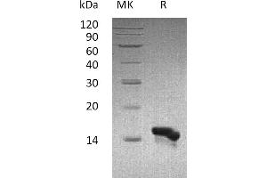 Greater than 95 % as determined by reducing SDS-PAGE. (CCL28 蛋白)