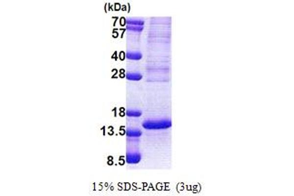 TP53AIP1 Protein (AA 1-124) (His tag)