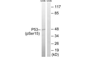 Western blot analysis of extracts from COS7 cells, using p53 (Phospho-Ser15) antibody. (p53 抗体  (pSer15))