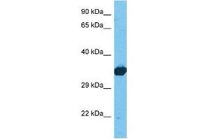Host:  Rabbit  Target Name:  LDHB  Sample Tissue:  Human 293T Whole Cell  Antibody Dilution:  1ug/ml (LDHB 抗体  (C-Term))