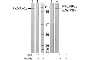 Image no. 1 for anti-Protein Kinase D1 (PRKD1) (Ser738) antibody (ABIN197313) (PKC mu 抗体  (Ser738))
