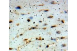 Used in DAB staining on fromalin fixed paraffin-embedded Heart tissue (ADIPOQ 抗体  (AA 108-244))