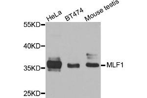 Western blot analysis of extracts of various cell lines, using MLF1 antibody (ABIN5974950) at 1/1000 dilution. (MLF1 抗体)