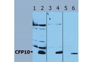 Image no. 1 for anti-Mycobacterium Tuberculosis Antigen CFP10 (Rv3874) antibody (ABIN238347) (Mycobacterium Tuberculosis Antigen CFP10 (Rv3874) 抗体)