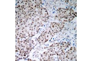 Immunohistochemistry (IHC) image for anti-Tumor Protein P53 (TP53) (pSer315) antibody (ABIN1870685) (p53 抗体  (pSer315))