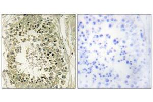 Immunohistochemistry (IHC) image for anti-Hepatocyte Growth Factor-Regulated tyrosine Kinase Substrate (HGS) (Internal Region) antibody (ABIN1848946) (HGS 抗体  (Internal Region))