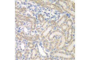 Immunohistochemistry of paraffin-embedded rat kidney using AUH antibody at dilution of 1:100 (x400 lens). (AUH 抗体)