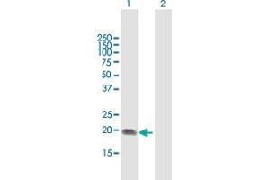 Western Blot analysis of ST6GAL1 expression in transfected 293T cell line by ST6GAL1 MaxPab polyclonal antibody. (ST6GAL1 抗体  (AA 1-175))