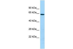WB Suggested Anti-KRT74 Antibody Titration: 1. (KRT74 抗体  (C-Term))