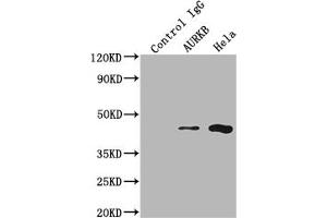 Western Blotting (WB) image for anti-Aurora Kinase B (AURKB) antibody (ABIN7127357)