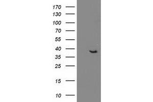 Western Blotting (WB) image for anti-DnaJ (Hsp40) Homolog, Subfamily B, Member 1 (DNAJB1) antibody (ABIN1498736) (DNAJB1 抗体)