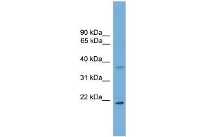 WB Suggested Anti-GSTM1  Antibody Titration: 0. (GSTM1 抗体  (C-Term))