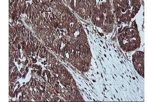 Immunohistochemistry (IHC) image for anti-LIM Domain Kinase 1 (LIMK1) antibody (ABIN1499146) (LIM Domain Kinase 1 抗体)