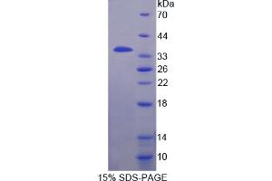 Image no. 1 for Fidgetin (FIGN) (AA 1-308) protein (His tag) (ABIN6238076) (Fidgetin Protein (FIGN) (AA 1-308) (His tag))