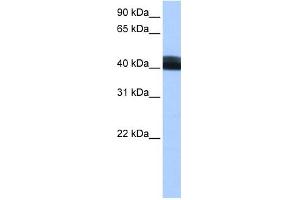 WB Suggested Anti-LRRC17 Antibody Titration: 0. (LRRC17 抗体  (Middle Region))