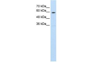 WB Suggested Anti-SLC11A1 Antibody Titration:  1. (SLC11A1 抗体  (C-Term))