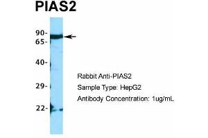 Host:  Rabbit  Target Name:  PIAS2  Sample Type:  HepG2  Antibody Dilution:  1. (PIAS2 抗体  (C-Term))