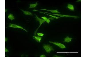 Immunofluorescence (IF) image for anti-Stress-Induced-phosphoprotein 1 (STIP1) (AA 1-543) antibody (ABIN524365)