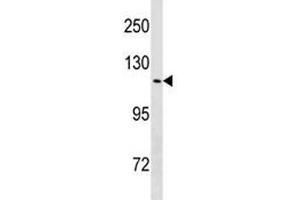 TRPV4 antibody western blot analysis in HeLa lysate. (TRPV4 抗体  (AA 160-189))