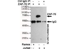 Immunoprecipitation analysis of Jurkat cell lysates (Z70 positive expression cell line)and Ramos cell lysates(Z70 negative expression cell line) using Z70 mouse mAb. (ZAP70 抗体)