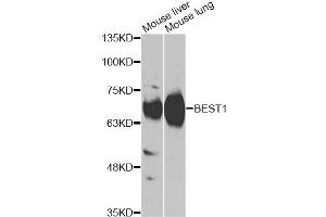 Western blot analysis of extracts of various cell lines, using BEST1 antibody (ABIN6290112) at 1:1000 dilution. (Bestrophin 1 抗体)