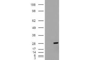 HEK293T cells were transfected with the pCMV6-ENTRY control (Left lane) or pCMV6-ENTRY BCL2L1 (RC201314) (Right lane) cDNA for 48 hrs and lysed. (BCL2L1 抗体  (AA 1-212))