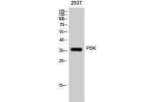 Western Blotting (WB) image for anti-PDZ Binding Kinase (PBK) (Tyr685), (Tyr753) antibody (ABIN3176791) (PBK 抗体  (Tyr685, Tyr753))