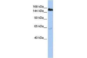 TNKS antibody used at 1 ug/ml to detect target protein. (TNKS 抗体  (Middle Region))