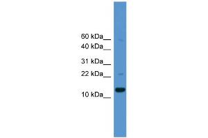 WB Suggested Anti-CASP1 Antibody Titration: 0. (Caspase 1 抗体  (Middle Region))