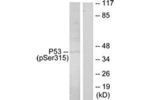 Western blot analysis of extracts from ovary cancer, using p53 (Phospho-Ser315) Antibody. (p53 抗体  (pSer315))