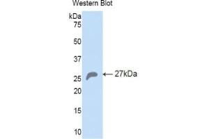 Detection of Recombinant HSPA5, Mouse using Polyclonal Antibody to Heat Shock 70 kDa Protein 5 (HSPA5) (GRP78 抗体  (AA 261-470))