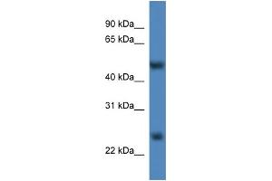 WB Suggested Anti-Mettl4 Antibody Titration:  0. (METTL4 抗体  (C-Term))