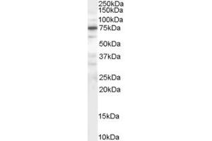 Western Blotting (WB) image for anti-Protein Phosphatase 1, Regulatory (Inhibitor) Subunit 15A (PPP1R15A) (AA 664-674) antibody (ABIN291973) (GADD34 抗体  (AA 664-674))