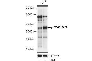Western blot analysis of extracts of HeLa cells, using Phospho-EIF4B-S422 antibody (ABIN6135212, ABIN6136060, ABIN6136061 and ABIN6225673) at 1:2000 dilution. (EIF4B 抗体  (pSer422))