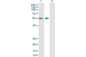 Western Blot analysis of KRT7 expression in transfected 293T cell line by KRT7 MaxPab polyclonal antibody. (Cytokeratin 7 抗体  (AA 1-469))