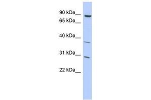 KLHL5 antibody used at 2. (KLHL5 抗体  (Middle Region))