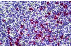 Anti-CAMP antibody IHC staining of human spleen, neutrophils. (Cathelicidin 抗体)