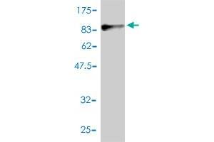 Western Blot detection against Immunogen (87. (Phosphoglucomutase 1 抗体  (AA 1-562))