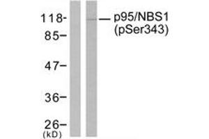Western Blotting (WB) image for anti-Nibrin (NBN) (pSer343) antibody (ABIN2888479) (Nibrin 抗体  (pSer343))