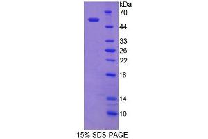 SDS-PAGE analysis of Mouse ECT2 Protein. (ECT2 蛋白)