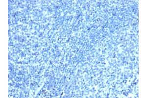 IHC analysis of formalin-fixed, paraffin-embedded human tonsil. (Recombinant CDX2 抗体)